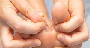 Athlete's foot is a fungal infection of the skin