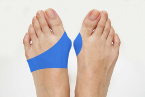 Bunion pads