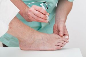 Cortisone shot for bunion pain