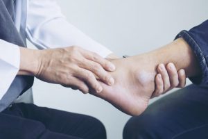 Houston foot doctor treats ankle sprains.