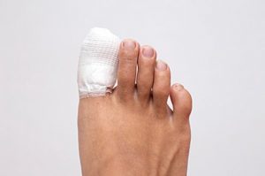 Patient with a broken big toe.