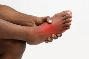If you have a lump on top of your foot, it may be due to a number of conditions.