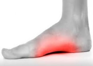 Arch pain can significantly impact mobility and daily activities, but expert podiatric care can offer relief and restore comfort.