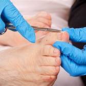 Ingrown toenails no more! Experience relief with our effective treatments.