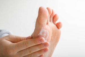 Regular exfoliation and hydration are key to preventing cracked heels.