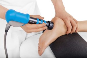 shockwave therapy for plantar fasciitis, heel pain, Achilles tendonitis