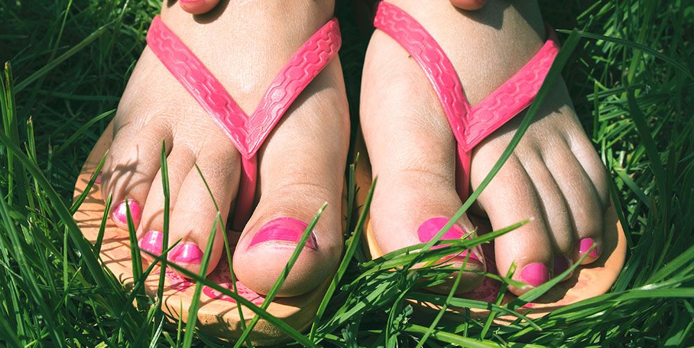 Can Flip Flops Cause Blisters on the Feet?