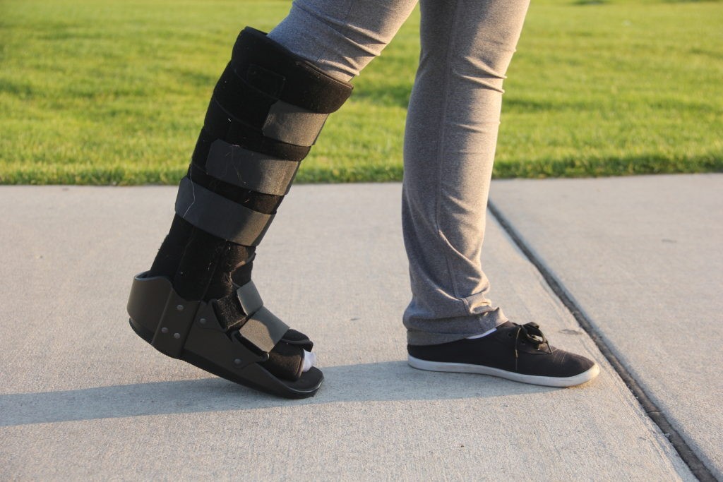 Fracture Boot Rubbing at Eric Hartle blog