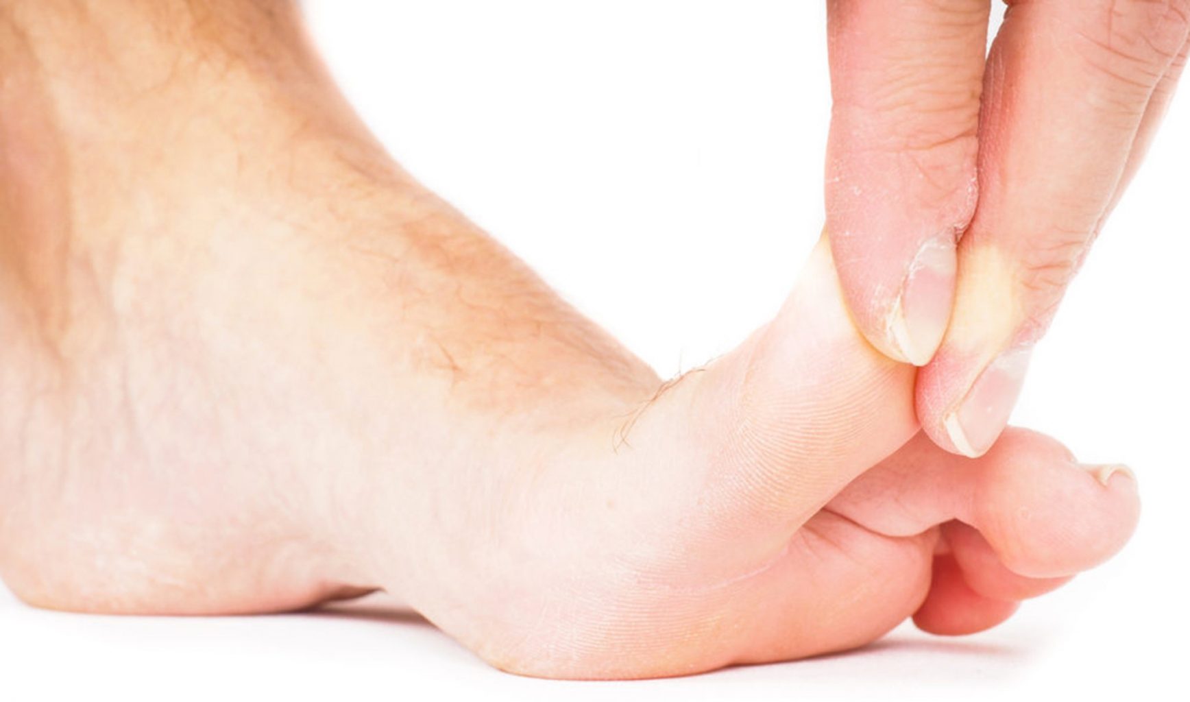 The 7 Common Causes of Big Toe Pain