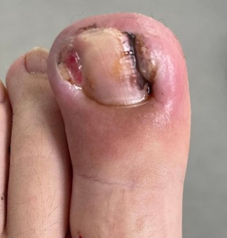Are You Cutting Your Toenails the Right Way?: The Foot & Ankle Specialists:  Podiatric Medicine