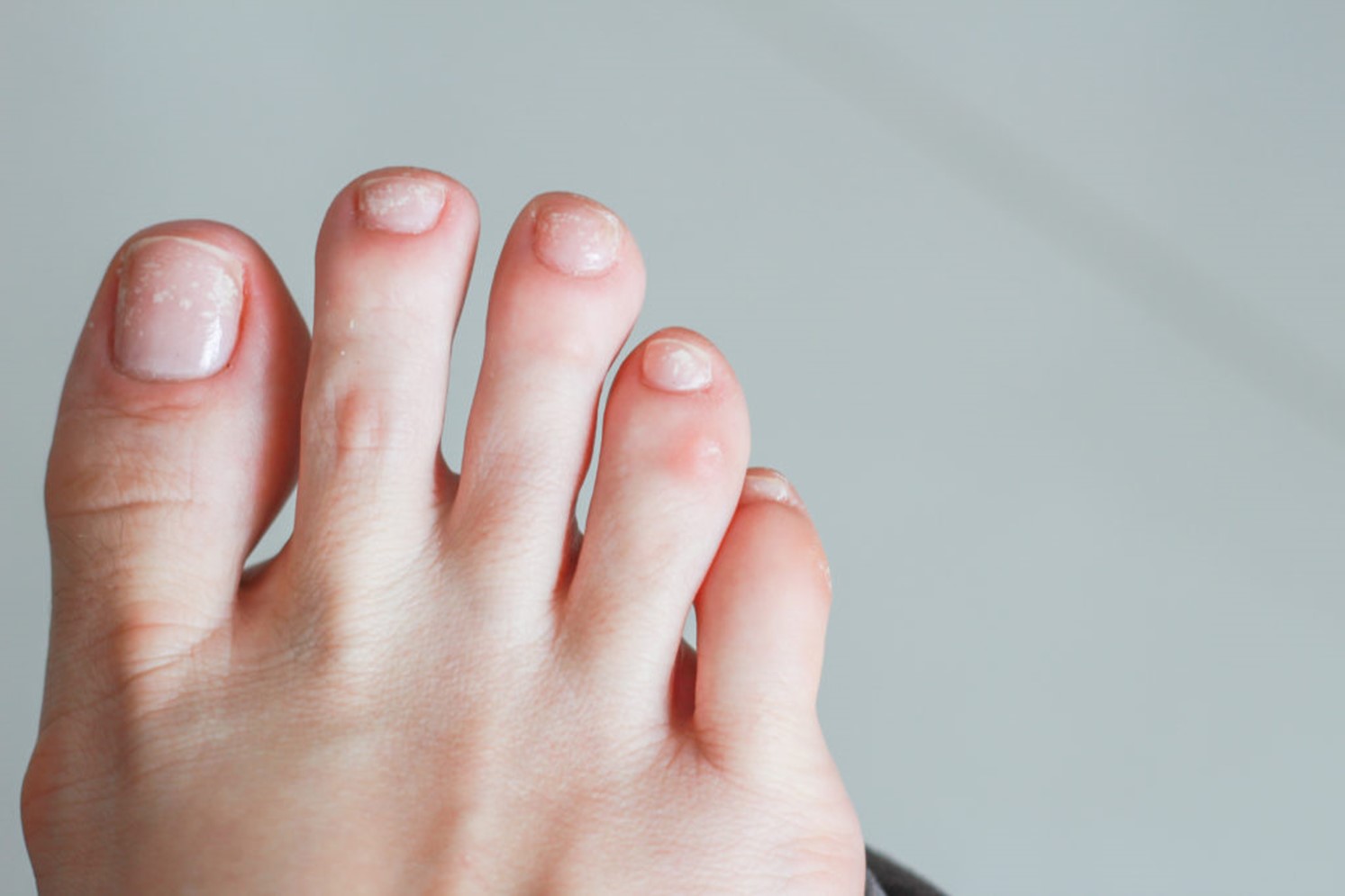 Photo of a Person's Feet with White Nail Polish · Free Stock Photo