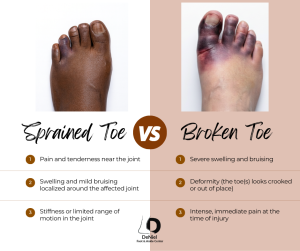 A broken toe indicates a fracture in the bone, while a sprain refers to the stretching or tearing of the ligaments surrounding the toe joint.