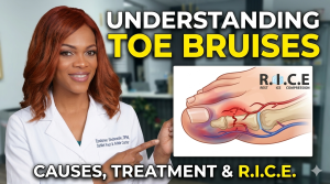 Treatment options for bruised toes