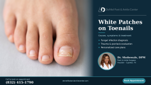 Noticing white patches on your toenails? Early evaluation makes all the difference. Schedule with Dr. Shobowale today.
