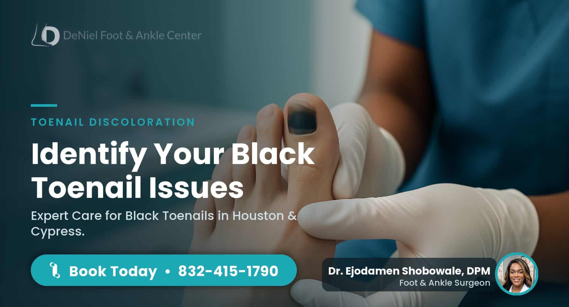 Close-up of a black toenail in a podiatry clinic, highlighting causes.