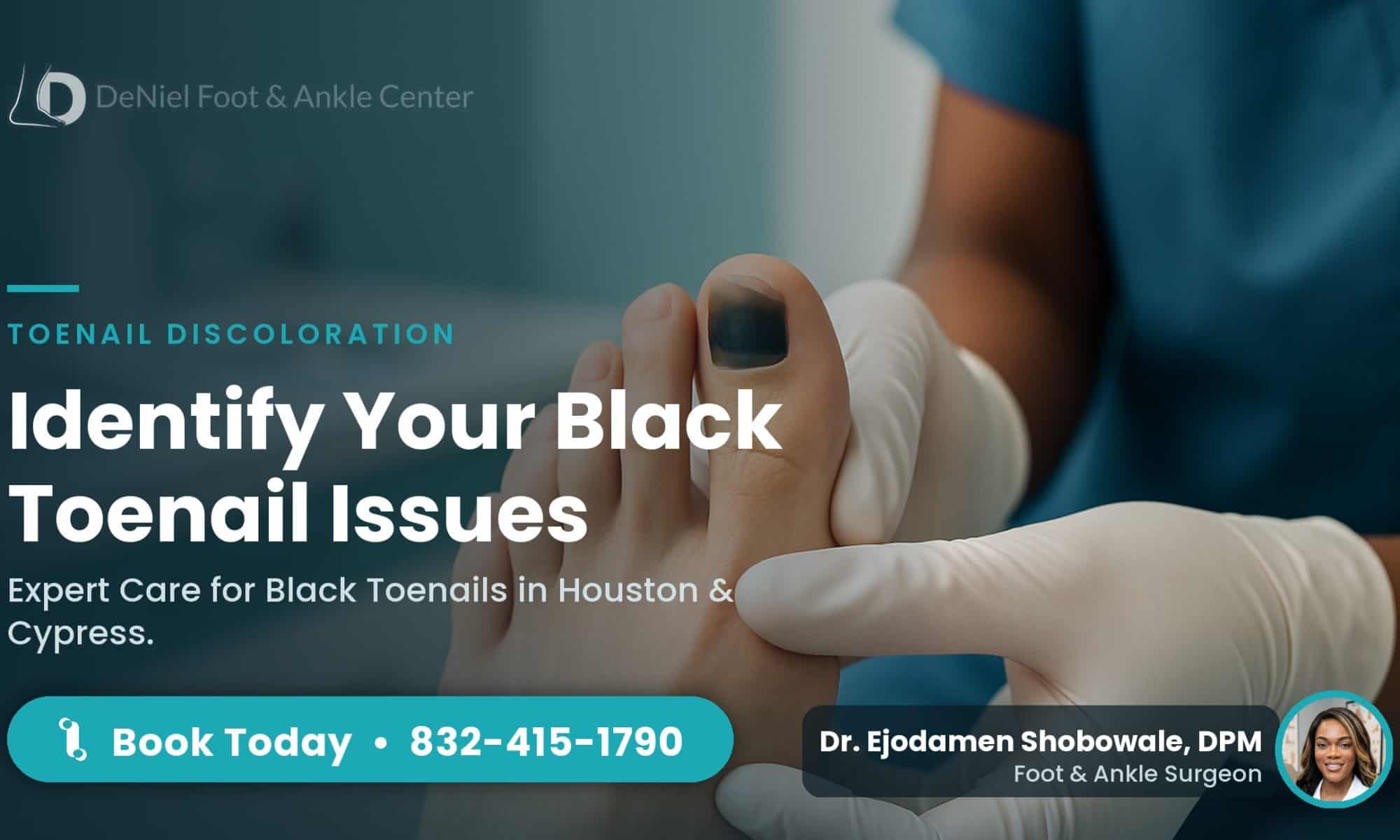 Close-up of a black toenail in a podiatry clinic, highlighting causes.