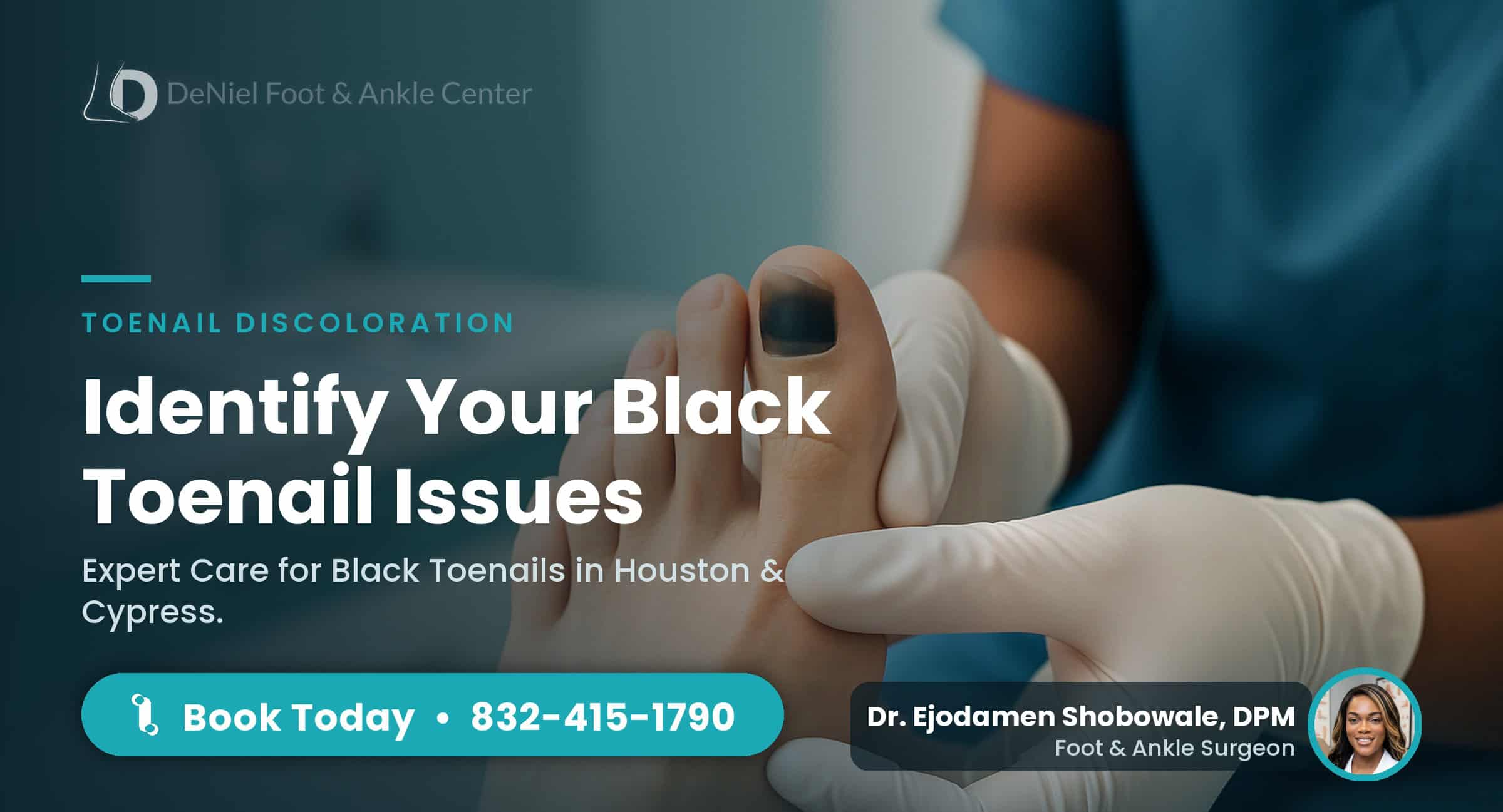 Close-up of a black toenail in a podiatry clinic, highlighting causes.