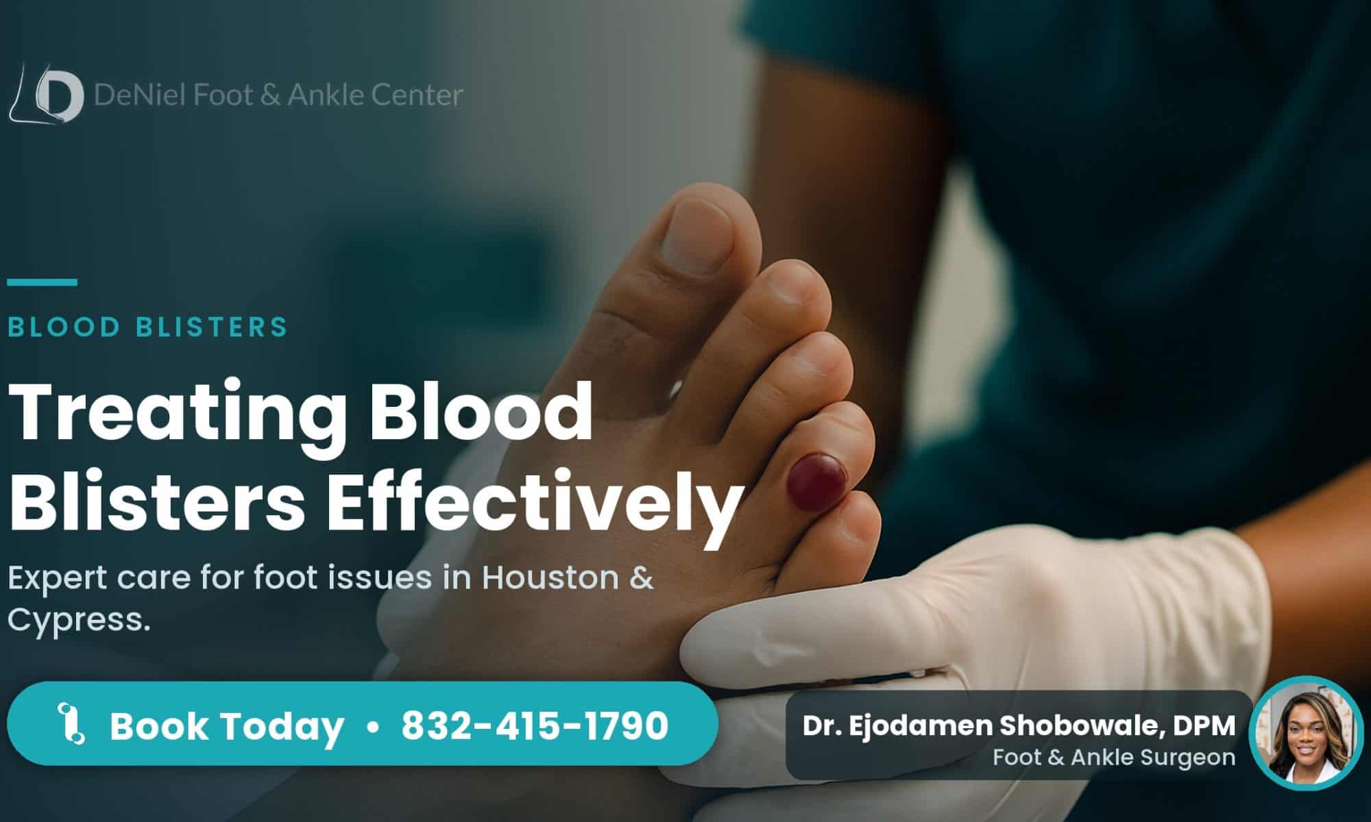 Blood blister on toe being examined at DeNiel Foot & Ankle Center.