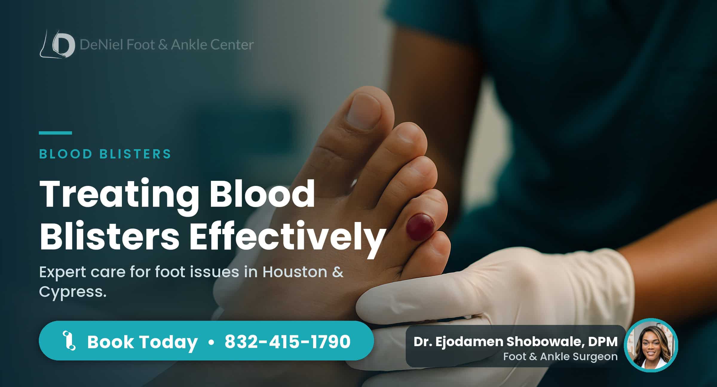 Blood blister on toe being examined at DeNiel Foot & Ankle Center.