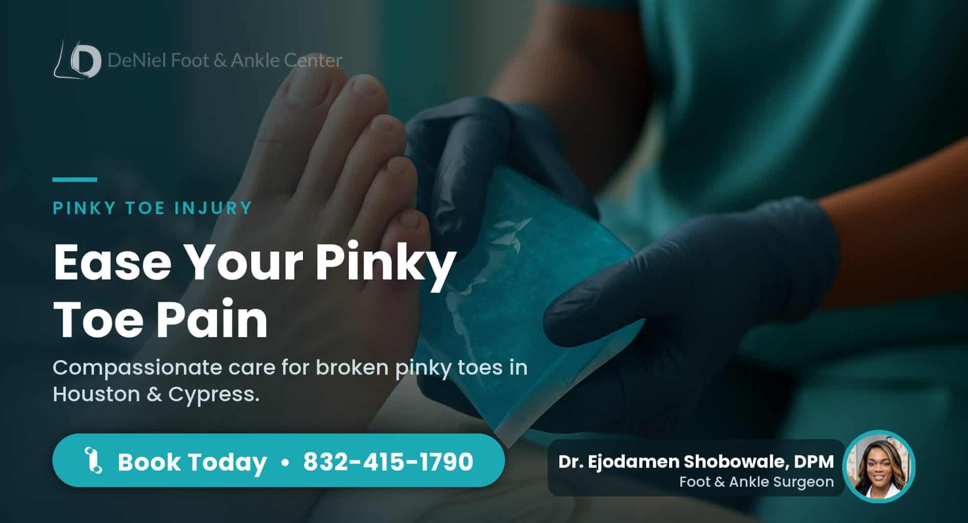 Close-up of an injured pinky toe being treated at home for a fracture.
