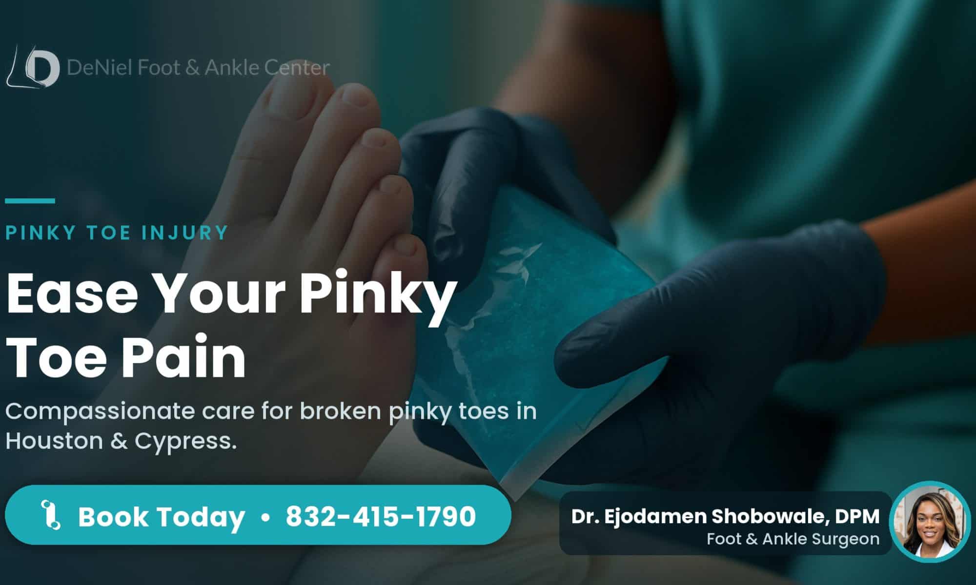Close-up of an injured pinky toe being treated at home for a fracture.