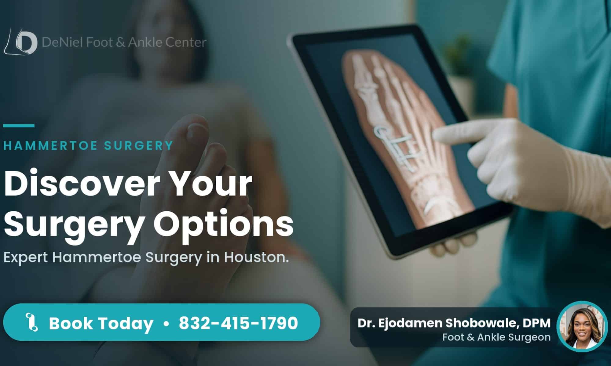 Hammertoe surgery consultation in Houston.