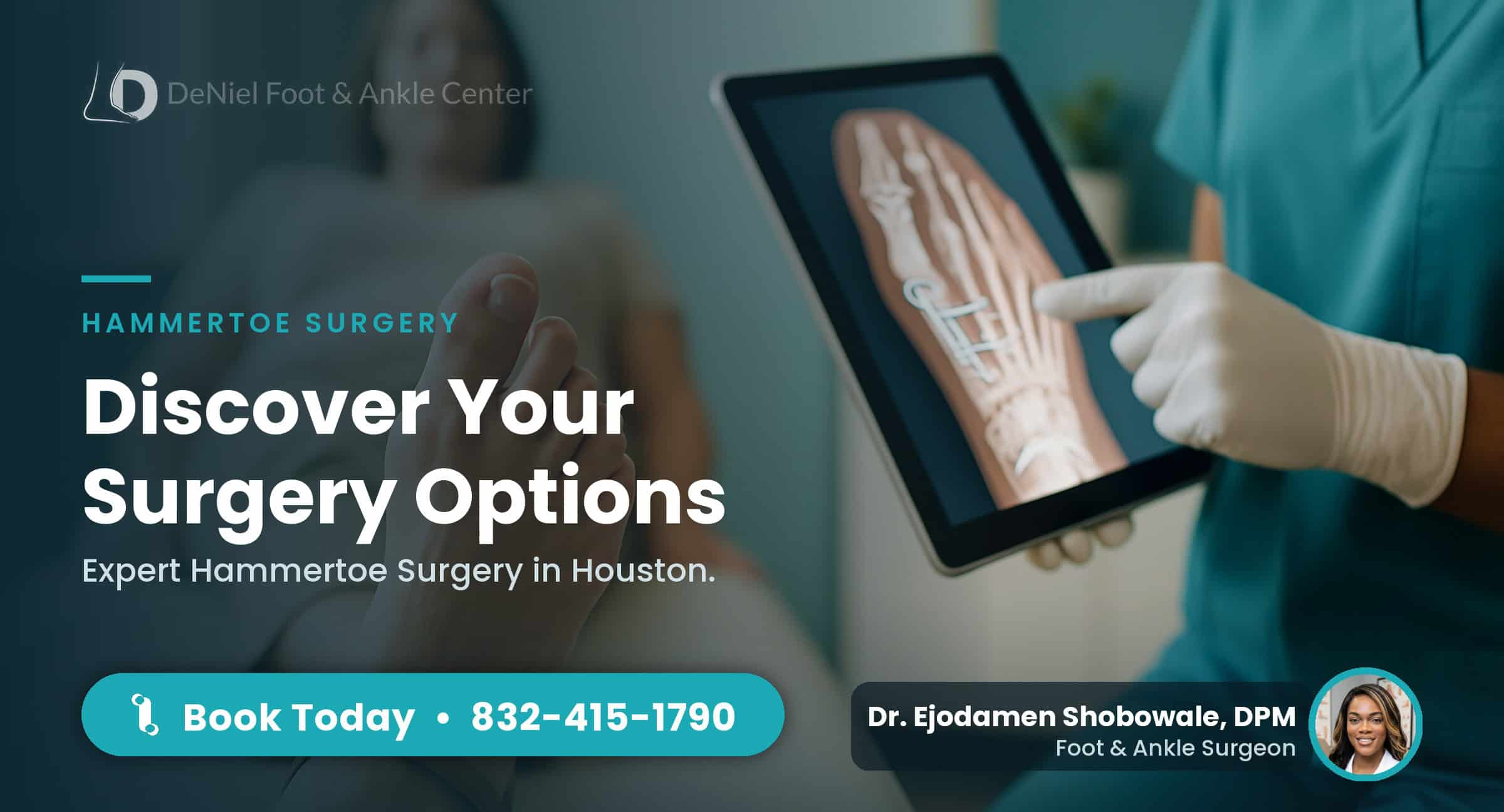 Hammertoe surgery consultation in Houston.