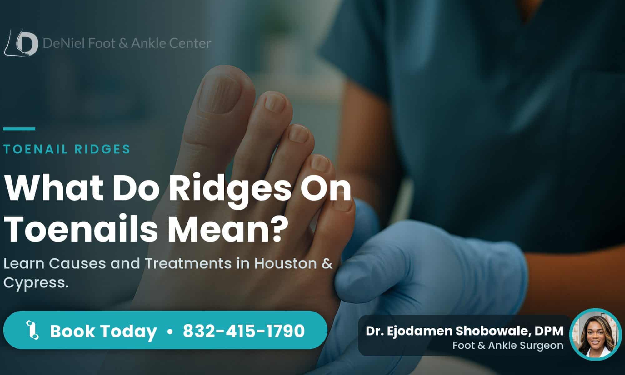 Ridges on toenails indicating potential health issues.