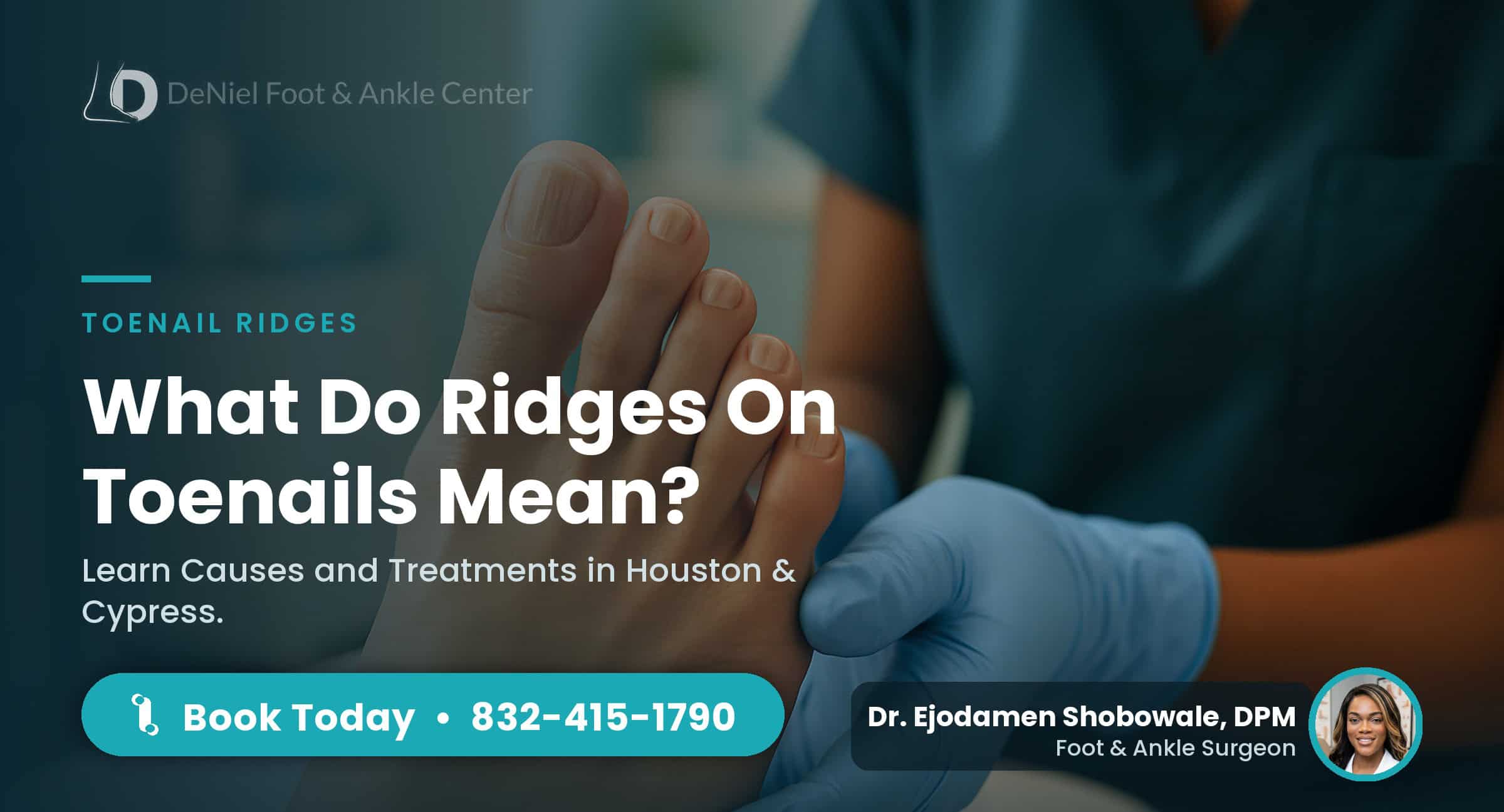 Ridges on toenails indicating potential health issues.