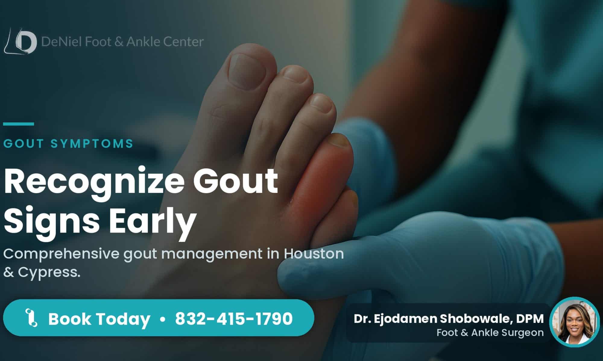 Swollen big toe indicating symptoms of gout.