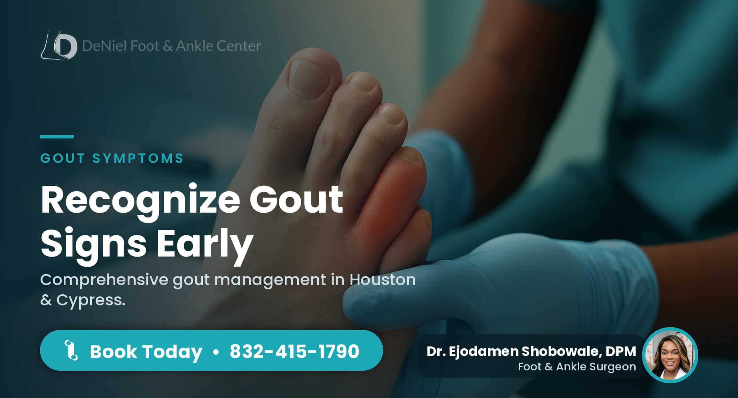 Swollen big toe indicating symptoms of gout.