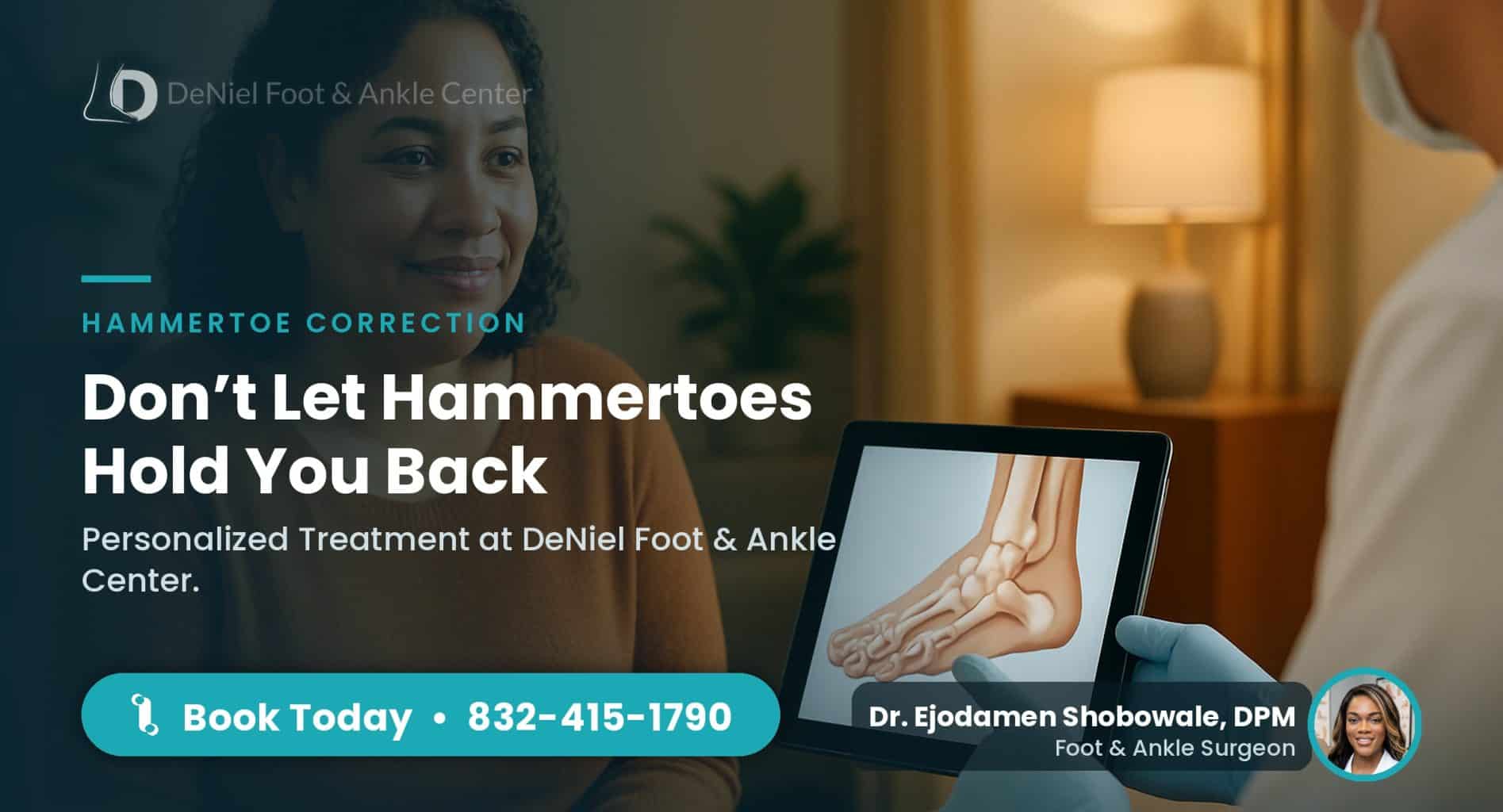Patient consultation for hammertoe correction in Cypress TX.