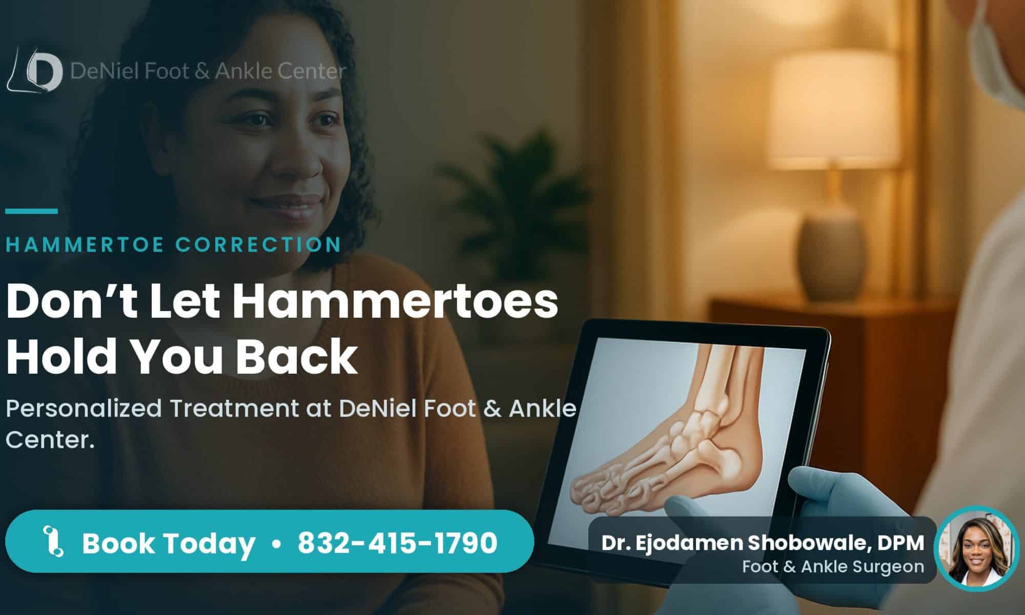 Patient consultation for hammertoe correction in Cypress TX.