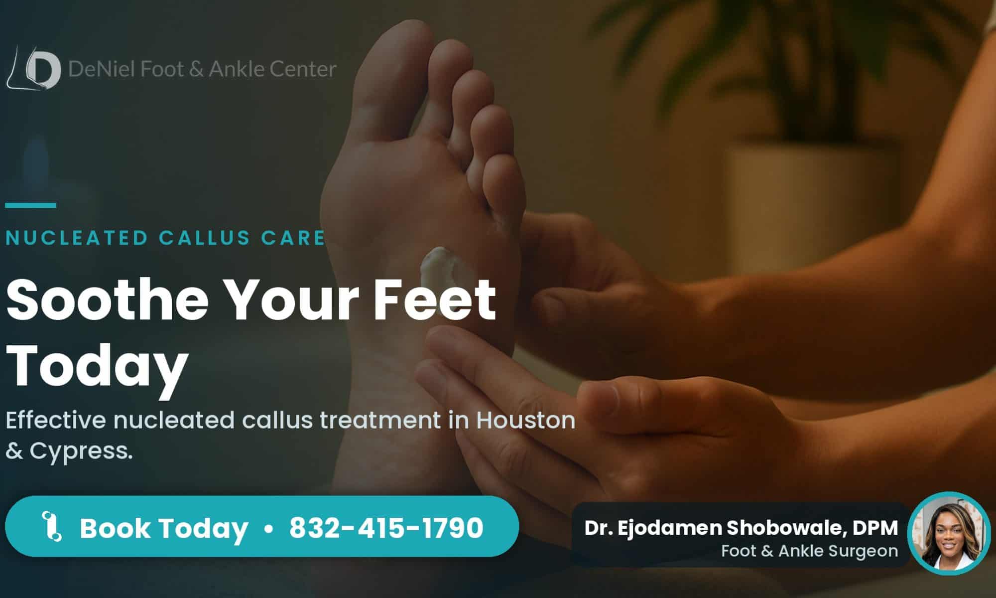 Gentle foot care for nucleated callus treatment.