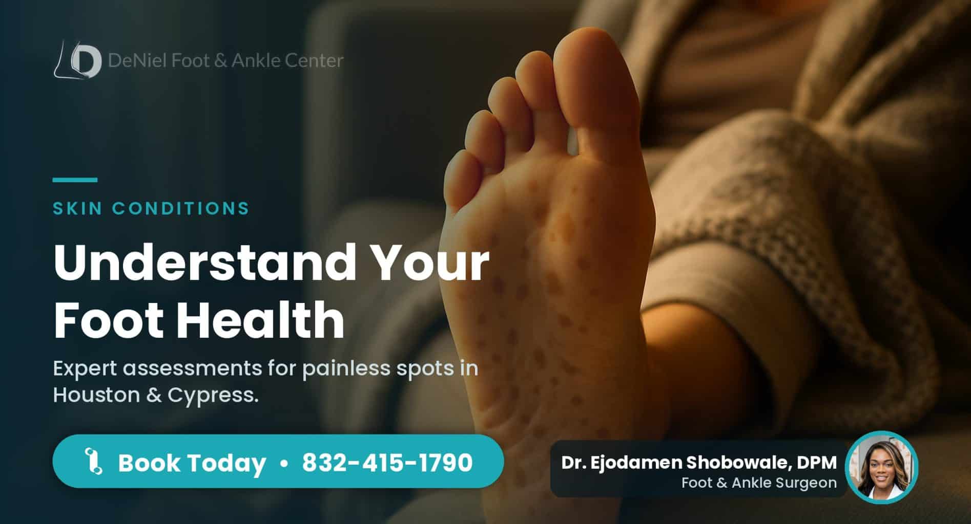 Painless brown spots on the bottom of a foot at home.