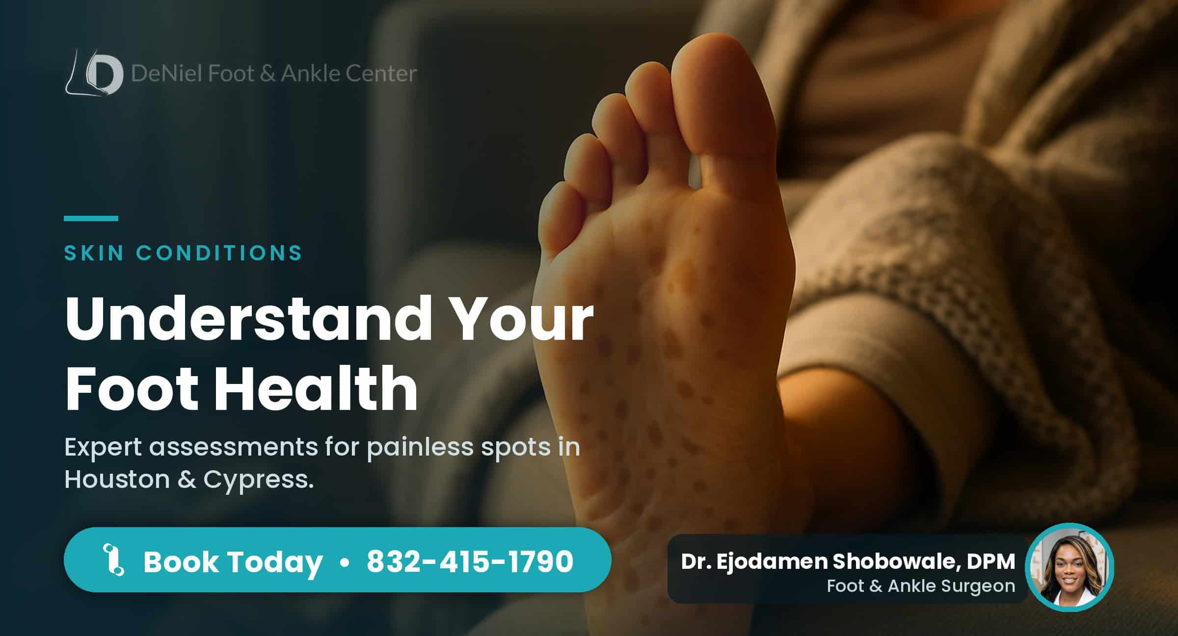 Painless brown spots on the bottom of a foot at home.