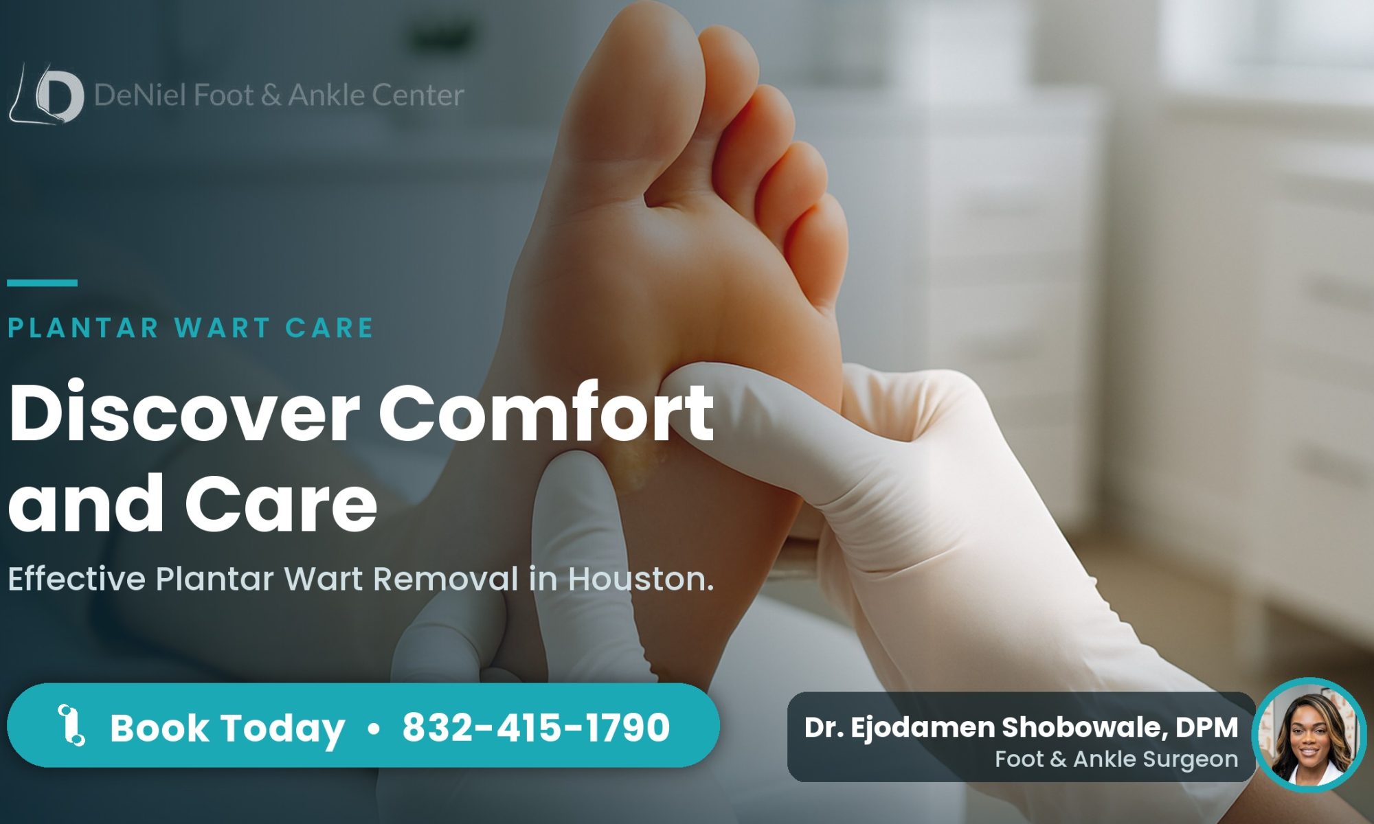 Examining a plantar wart in a podiatry clinic in Houston.