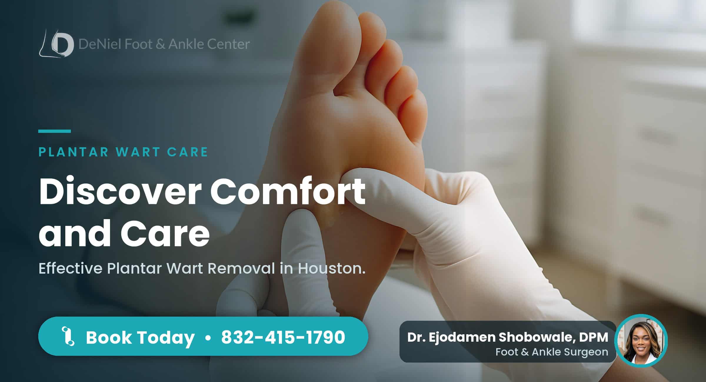 Examining a plantar wart in a podiatry clinic in Houston.