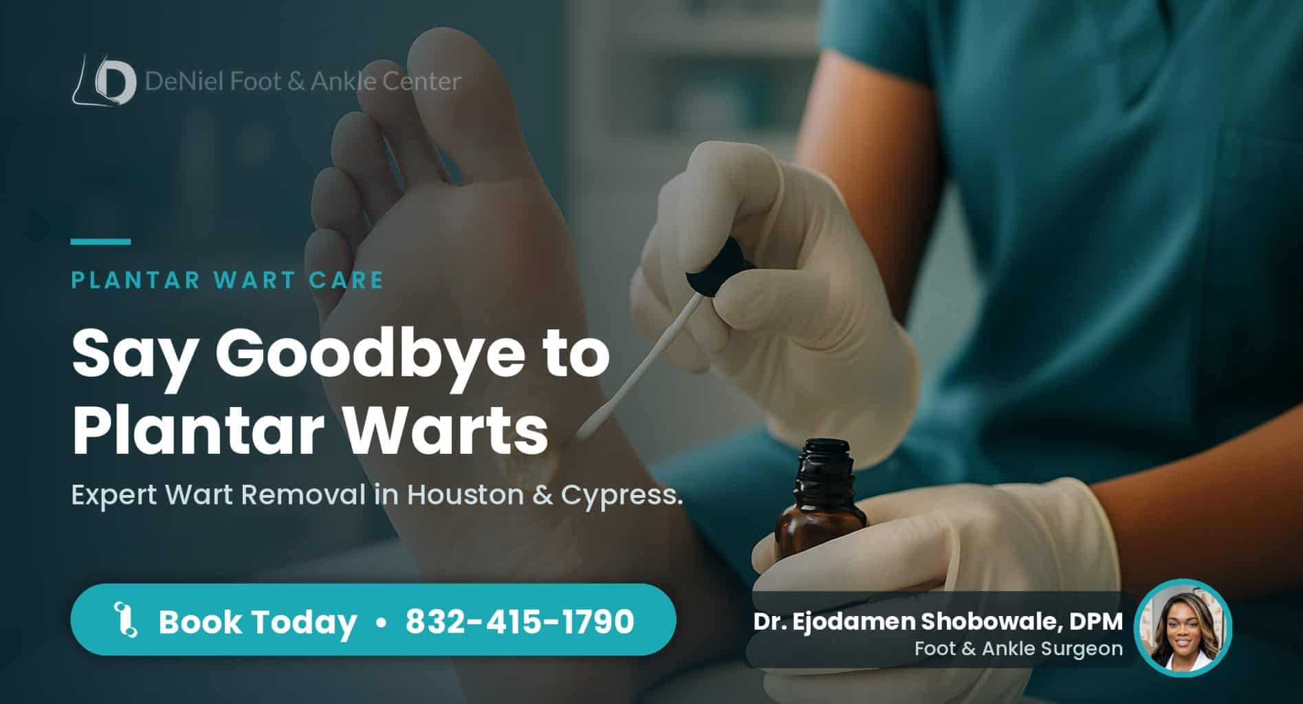 Plantar wart removal treatment in Houston.
