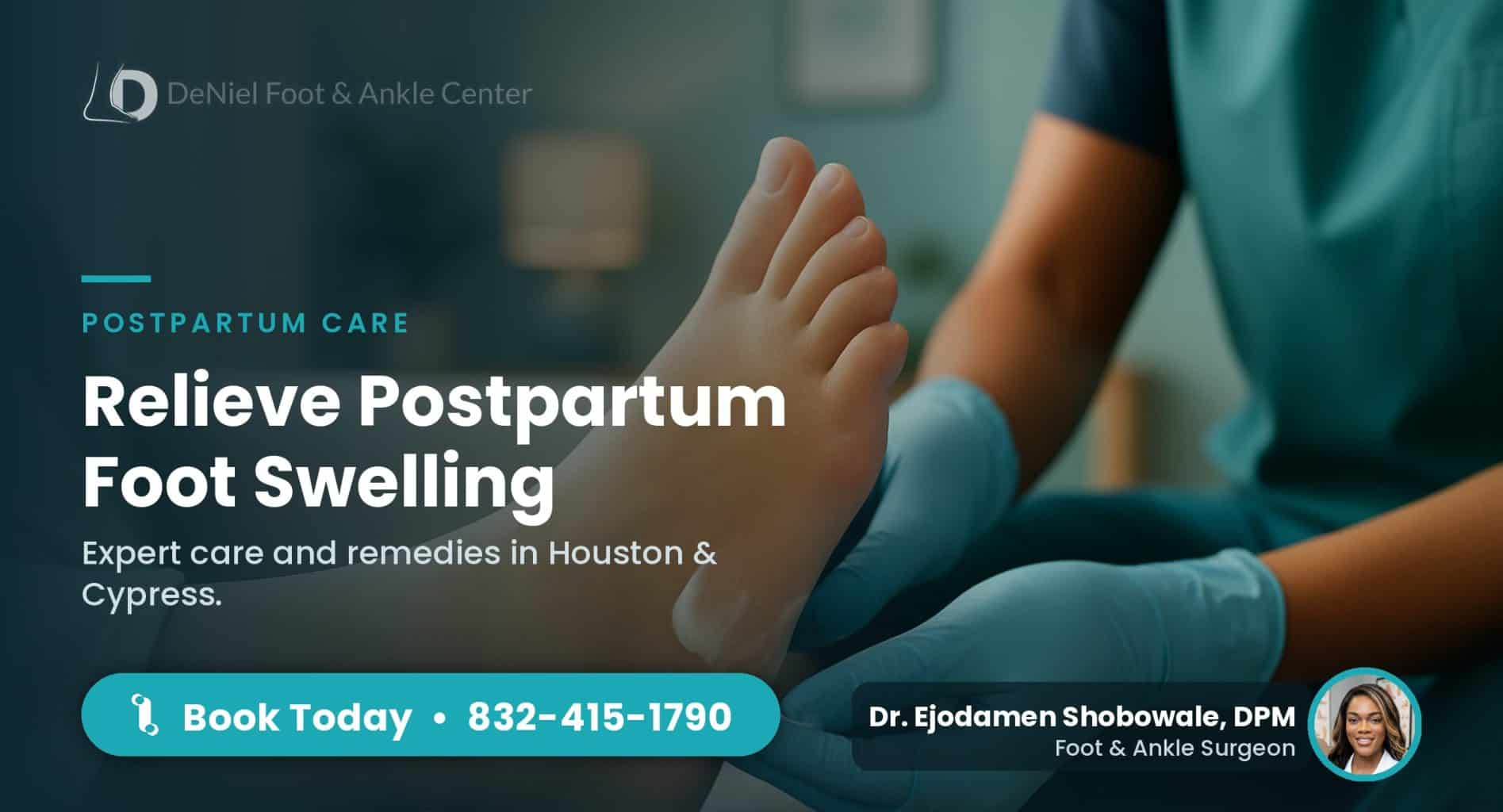 Postpartum foot swelling treatment in Houston.