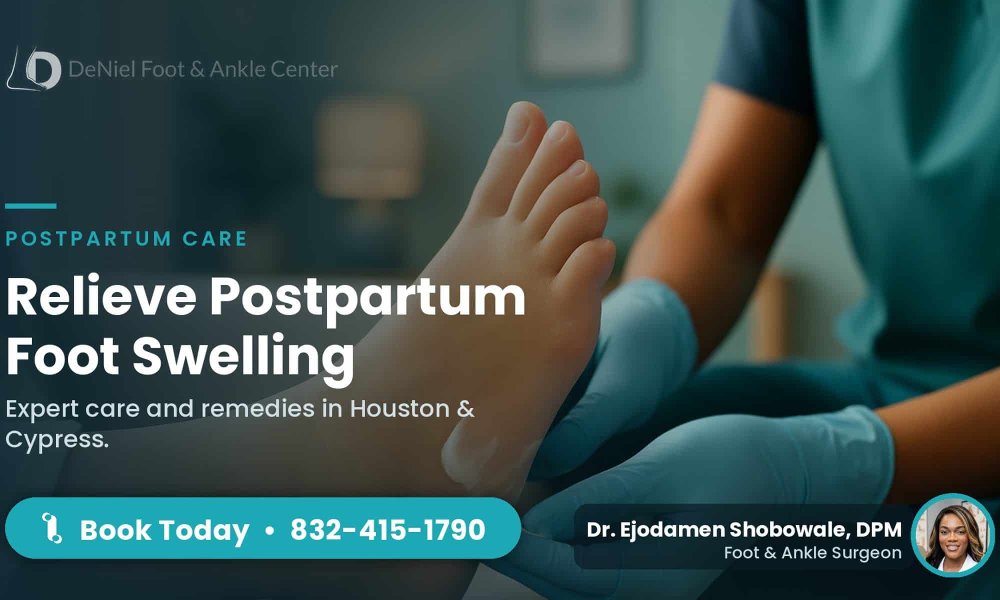 Postpartum foot swelling treatment in Houston.