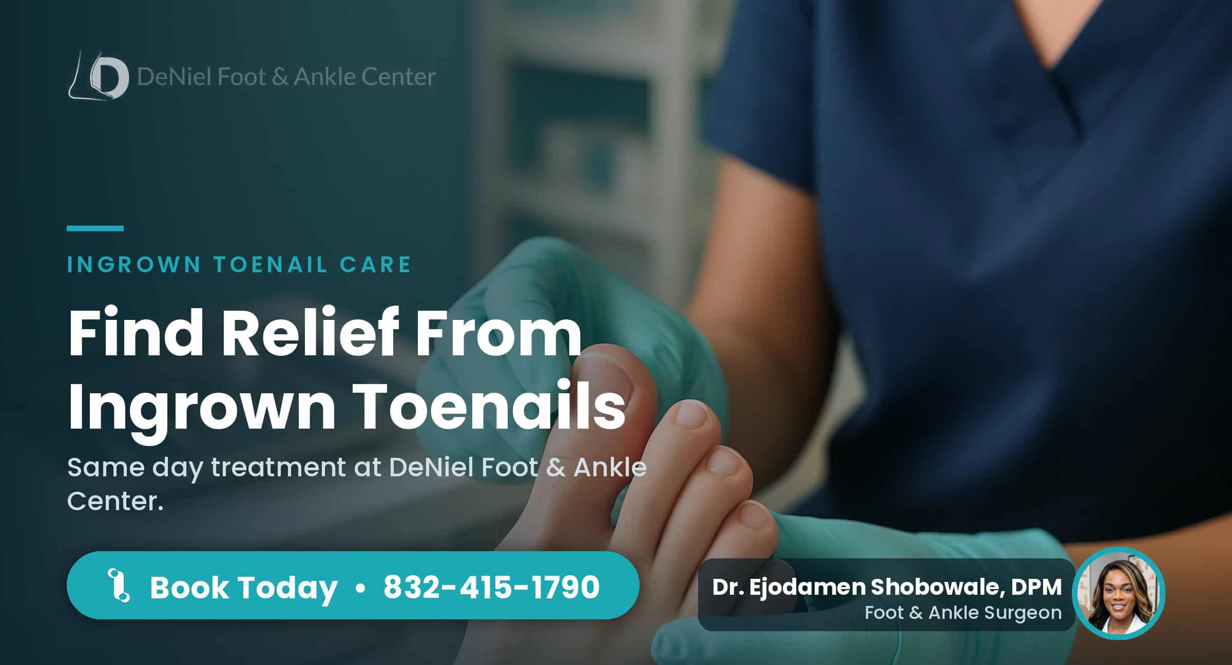 Same day ingrown toenail removal in Houston clinic.